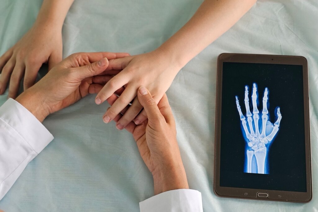 Imagem de mãos de médico avaliando mãos de uma criança e ao lado um tablet com a imagem de um raio-x de mão e punho